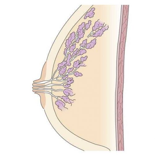 lipoma-mol-zhelezy