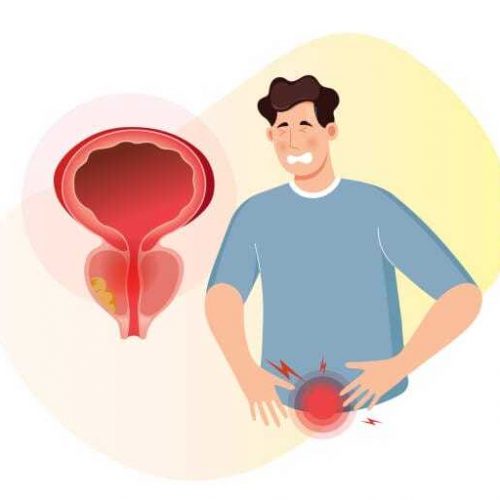 prostatitis